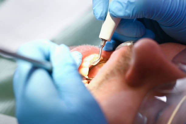 Best Broken or Cracked Tooth Emergency Dentist in Bonadelle Ranchos, CA