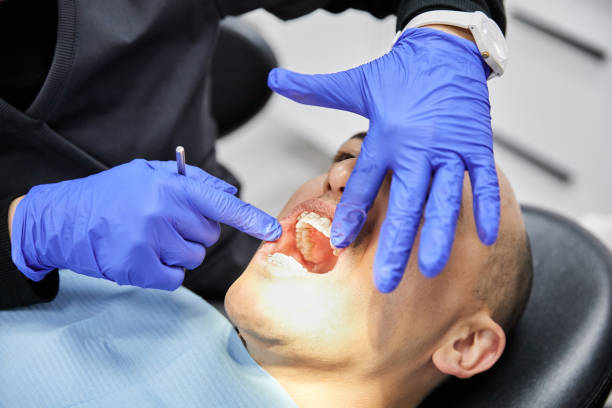 Best Weekend Emergency Dentist in Bonadelle Ranchos, CA