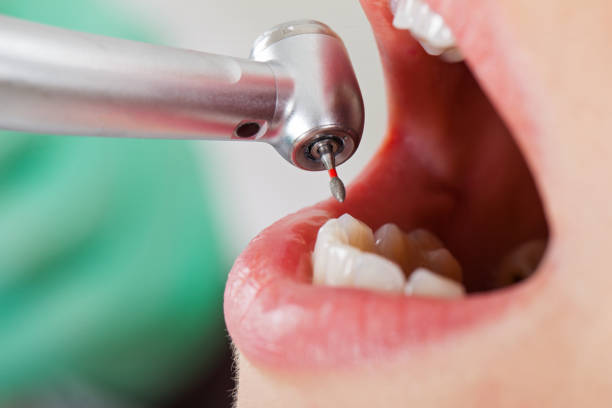 Best Emergency Dental Services for Seniors in Bonadelle Ranchos, CA